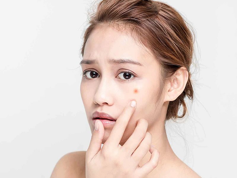 Cilde Zarar Veren Besinler Cilde Zarar Veren Besinler