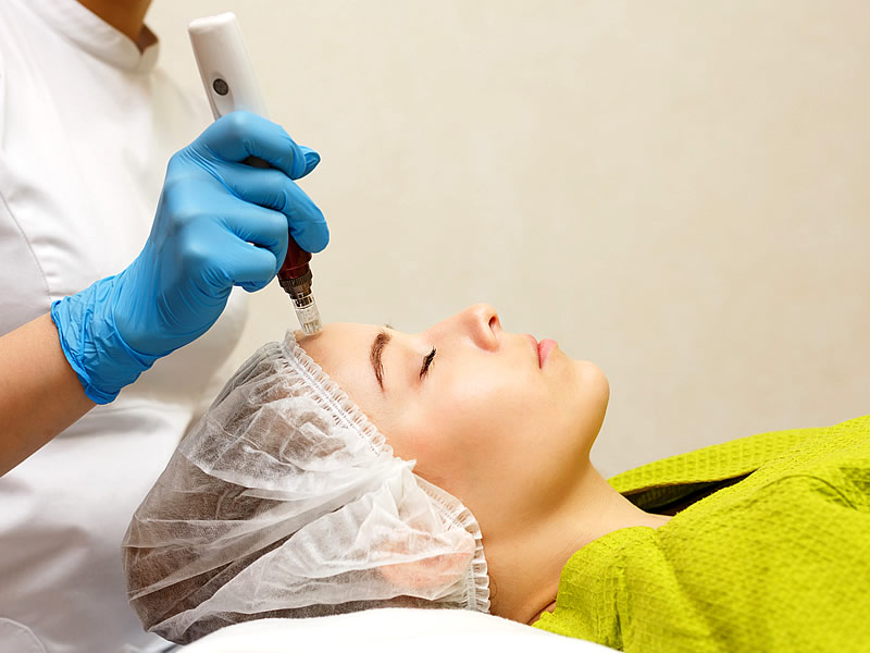 Dermapen Nedir? Faydaları Nelerdir? Dermapen Tedavisinin Yan Etkileri Nelerdir?