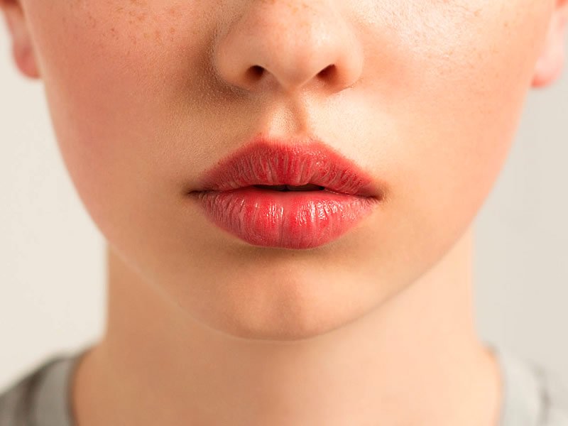 Dudak Dolgunlaştırmak için Yöntemler