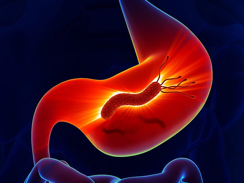 Helicobacter Pylori