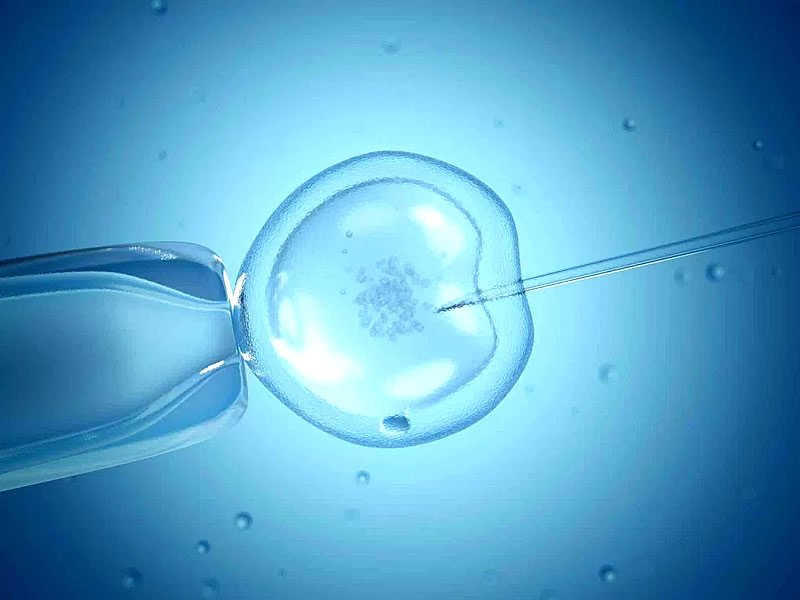 In vitro fertilizasyon nedir? Nasıl yapılır?
