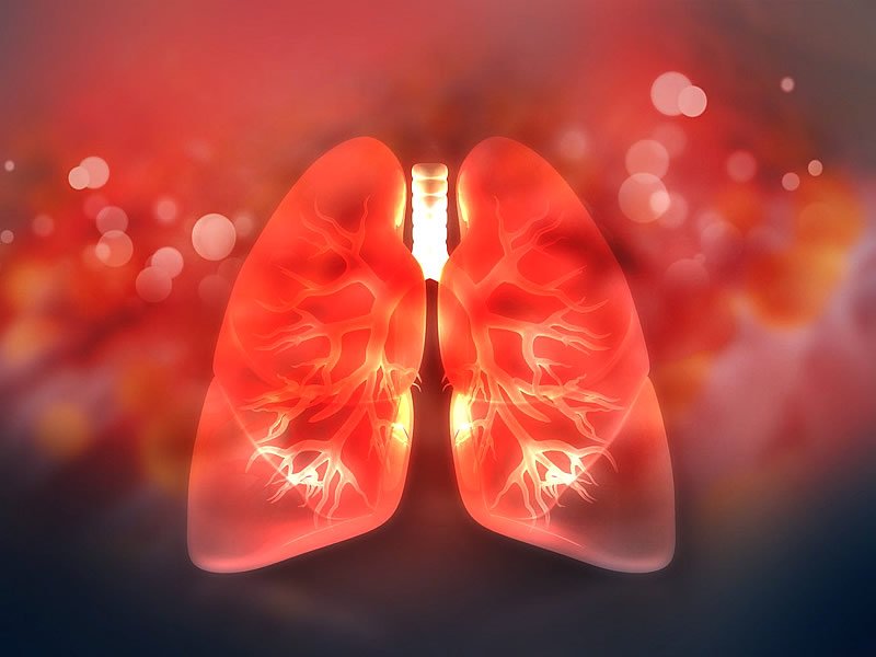 Küçük Hücreli Akciğer Kanseri Yaşam Süresi