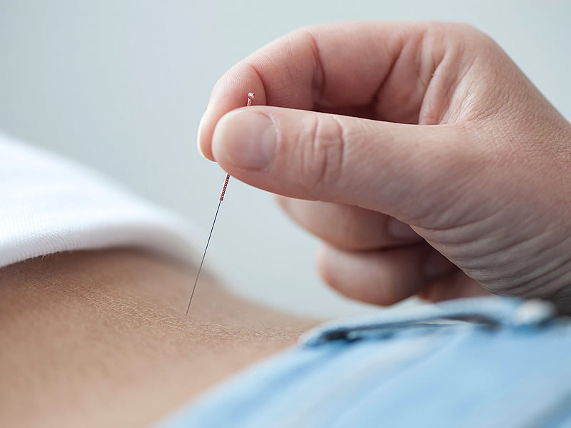 Nöral Terapi Nedir? Yan Etkileri ve Faydaları Nelerdir? Fiyatları Ne Kadar?
