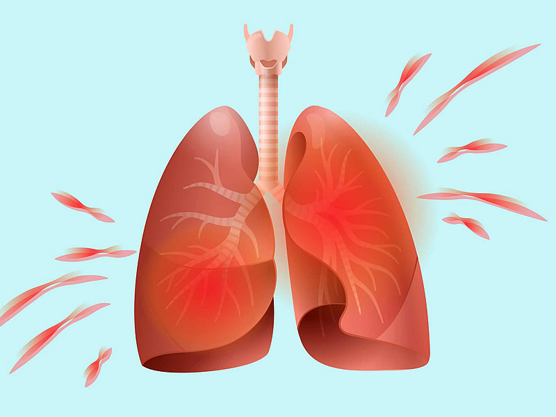 Pulmoner Rehabilitasyon Nedir? Nasıl Yapılır? Egzersizleri Nelerdir?