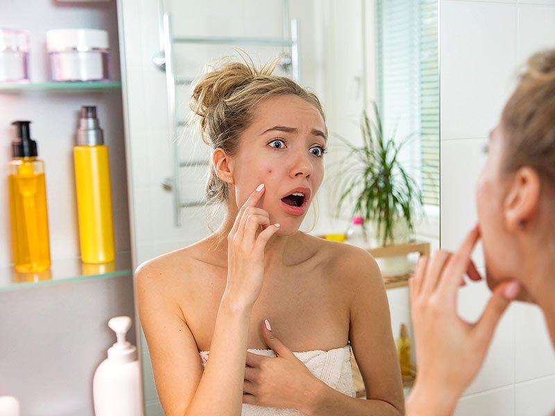 Sivilce Geçiren Şeyler Sivilce Geçiren Şeyler