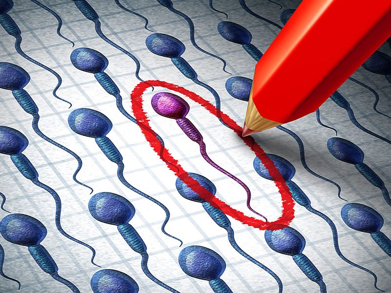 Sperm Testi Nedir? Nasıl Yapılır? Fiyatı Ne Kadar?