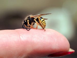 Arı Sokmasının Faydaları ve Zararları Nelerdir? Belirtileri ve Tedavisi