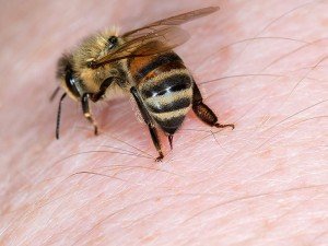 Arı Soktuğunda Ne Yapılmalı? Arı Sokması Şişliği Nasıl Geçer, Şişlik Nasıl İner?