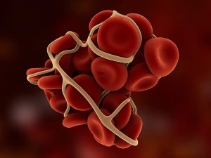 Koronavirüs Kan Pıhtılaşması Yapar mı? Belirtileri ve Tedavisi