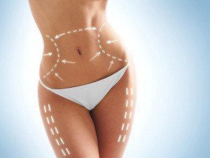 Liposakşın (Liposuction) Nedir? Liposakşın Nasıl Yapılır?