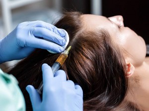 Mezoterapi Nedir? Saç Tedavisi Nasıl Yapılır? Ne İşe Yarar?