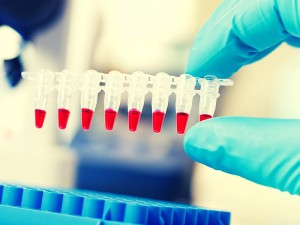 Pcr Testi Nedir? Korona Virüs Pcr Testi Nasıl Yapılır?